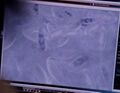 Mohinder views unaltered chromosomes under a microscope before applying his serum.