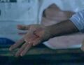 On "Nathan's" hand before he cleans it. (The Fifth Stage)