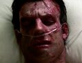 Adam injects his blood into Nathan, healing him of radiation burns. (Four Months Ago...)
