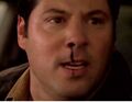 Matt struggles to overcome the Haitian's ability, resulting in a nosebleed. (Fallout )
